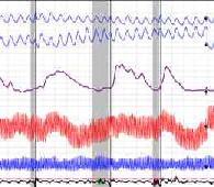 poly Chart